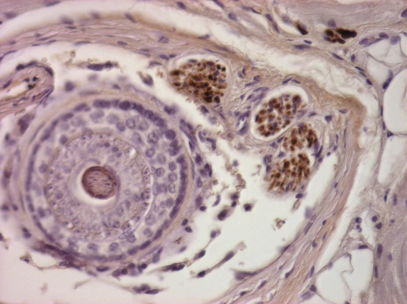 Regenerated whisker follicle and associated innervation in spiny mouse skin